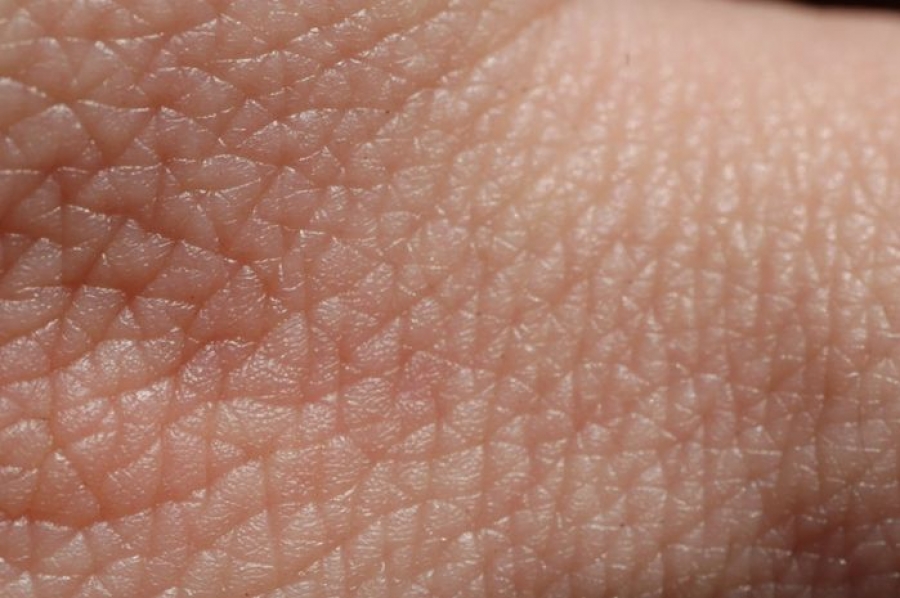 Taller: dermatologa laboral