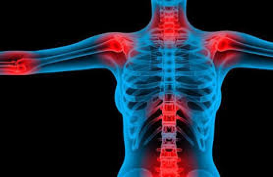 SEMG. Gua de actualizacin en la valoracin de fibromialgia, sndrome de fatiga crnica, sensibilidad qumica mltiple, electrosensibilidad y trastornos somatomorfos