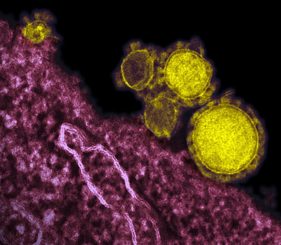 Criterio sobre incapacidad temporal por Coronavirus SARS-CoV-2