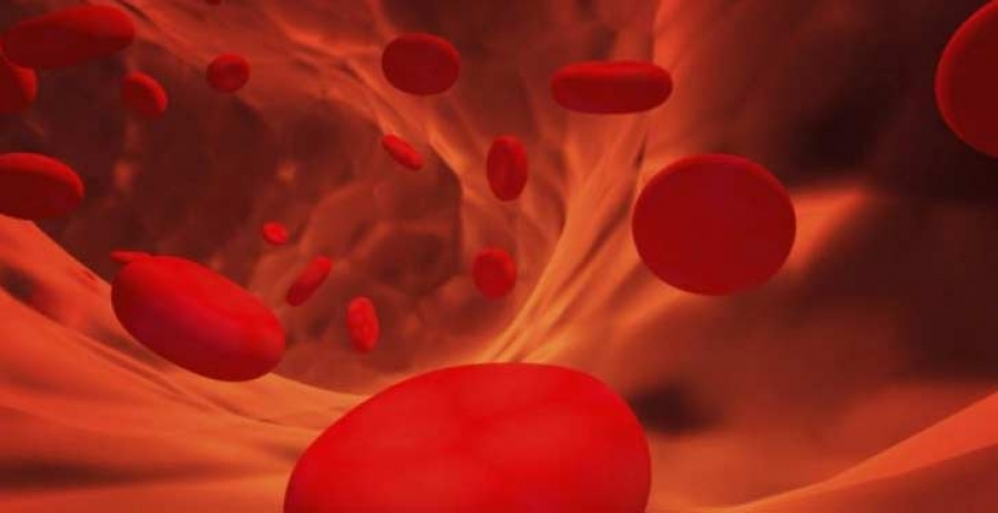 Exposici�n ocupacional a agentes qu�micos y neoplasias hematol�gicas